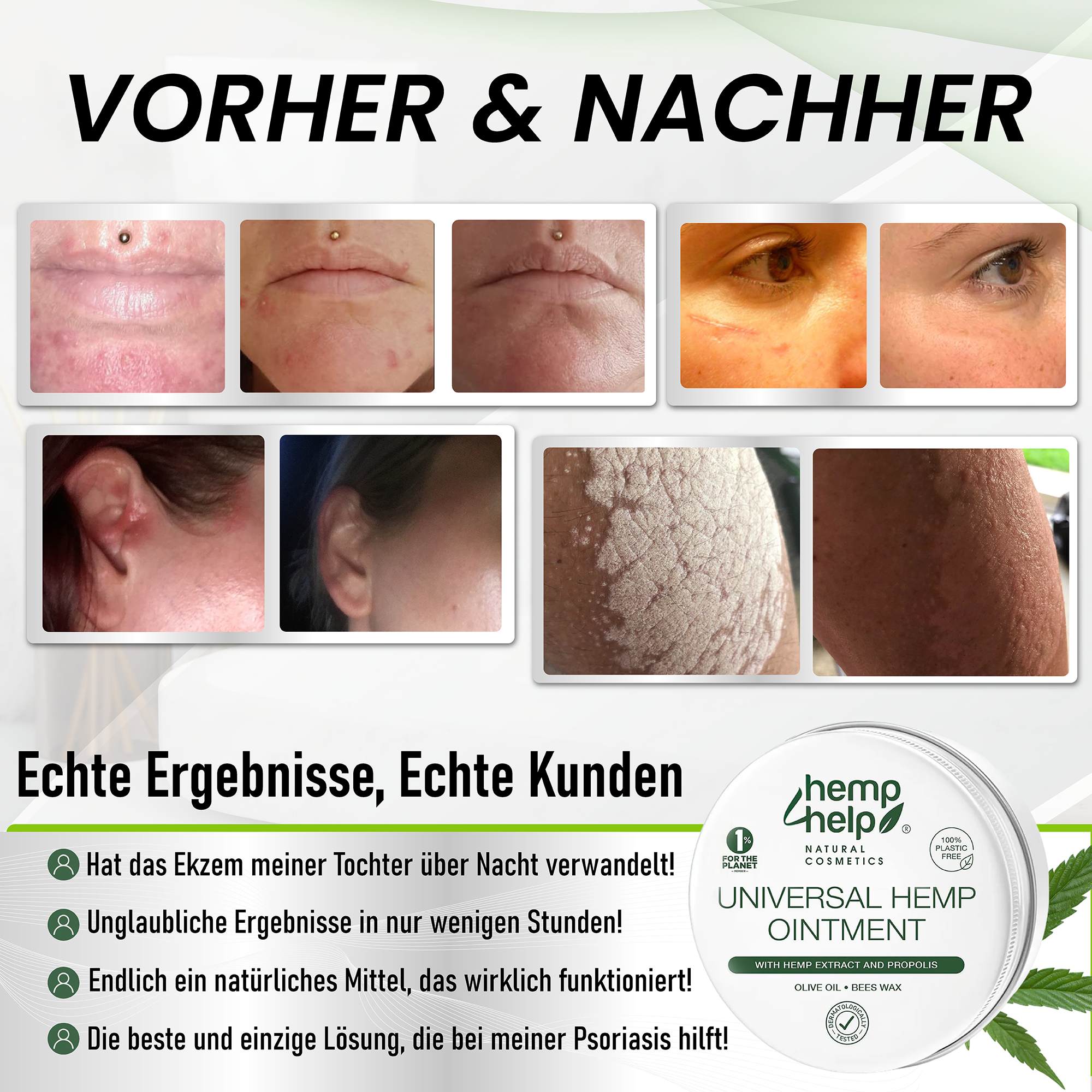 Roll-On HEMP Bio 14 Ml – Pflege Für Hautirritationen | Bei Mückenstichen, Ekzemen & Prellungen